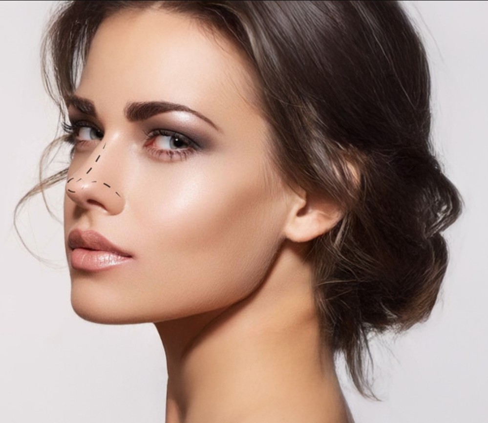 Kayseri burun estetiği